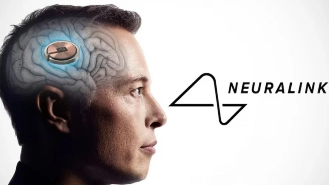 Elon Musk’s Neuralink has put an implant into a human brain